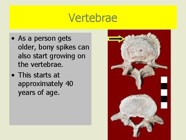 Vertebrae • As a person gets older, bony spikes can also start growing on