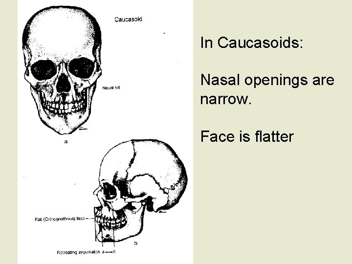 In Caucasoids: Nasal openings are narrow. Face is flatter 