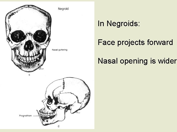 In Negroids: Face projects forward Nasal opening is wider 