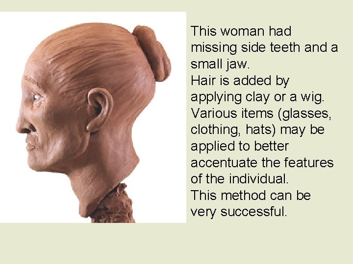 This woman had missing side teeth and a small jaw. Hair is added by