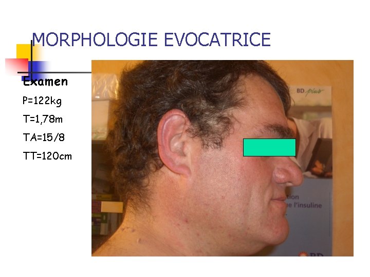 MORPHOLOGIE EVOCATRICE Examen P=122 kg T=1, 78 m TA=15/8 TT=120 cm MORPHOLOGIE EVOCATRICE Examen P=122 kg T=1, 78 m TA=15/8 TT=120 cm
