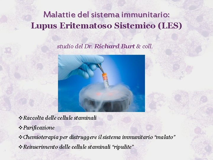 Malattie del sistema immunitario: Lupus Eritematoso Sistemico (LES) studio del Dr. Richard Burt &
