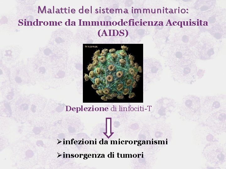 Malattie del sistema immunitario: Sindrome da Immunodeficienza Acquisita (AIDS) Deplezione di linfociti-T Øinfezioni da