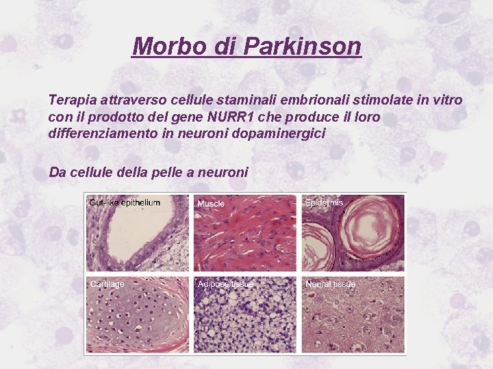 Morbo di Parkinson Terapia attraverso cellule staminali embrionali stimolate in vitro con il prodotto