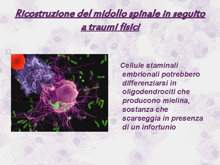 Ricostruzione del midollo spinale in seguito a traumi fisici Cellule staminali embrionali potrebbero differenziarsi