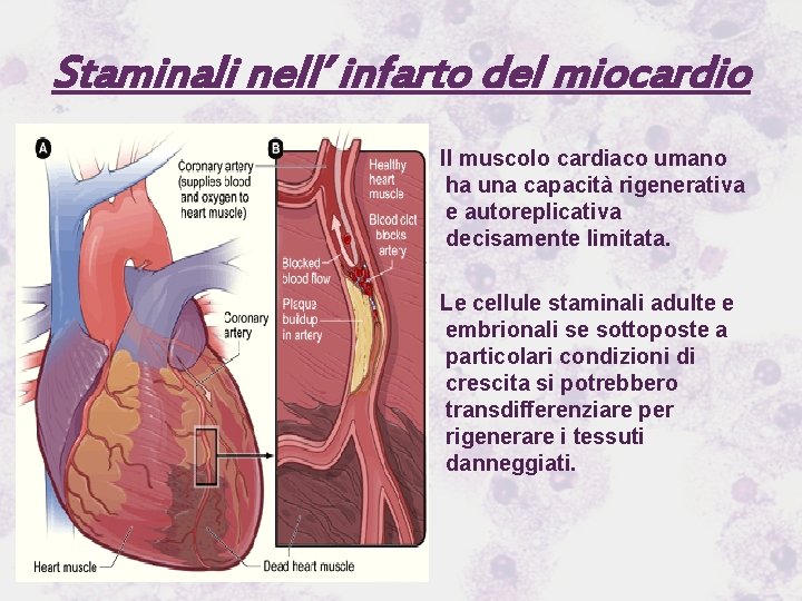Staminali nell’ infarto del miocardio Il muscolo cardiaco umano ha una capacità rigenerativa e