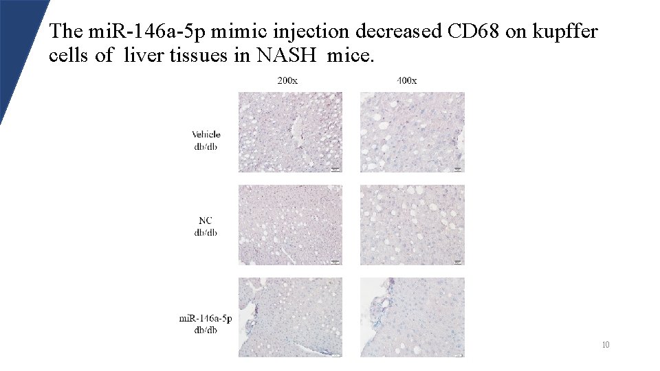 The mi. R-146 a-5 p mimic injection decreased CD 68 on kupffer cells of