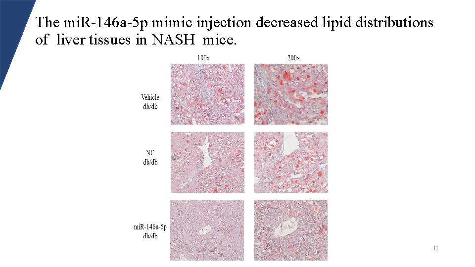 The mi. R-146 a-5 p mimic injection decreased lipid distributions of liver tissues in