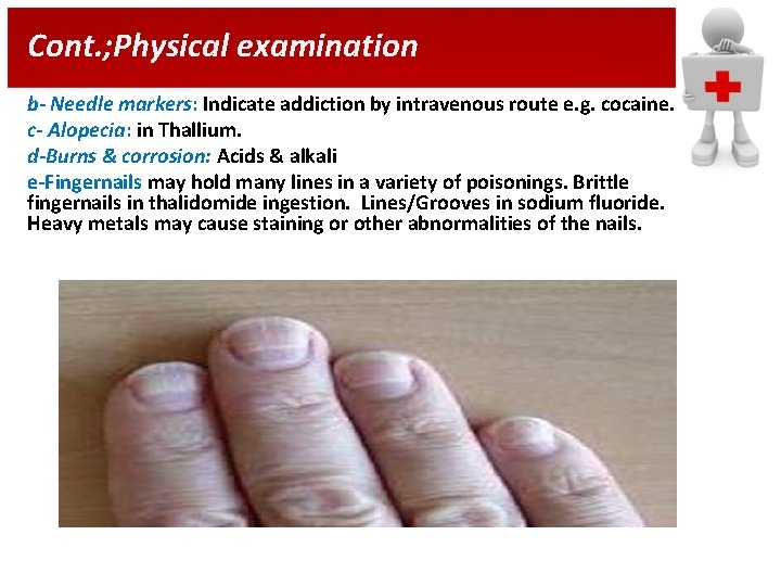 Cont. ; Physical examination b- Needle markers: Indicate addiction by intravenous route e. g.