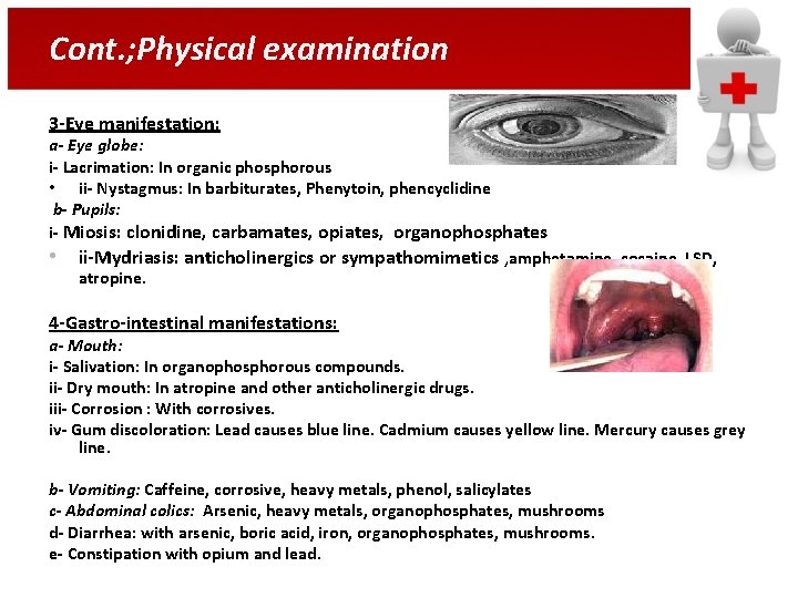 Cont. ; Physical examination 3 -Eye manifestation: a- Eye globe: i- Lacrimation: In organic