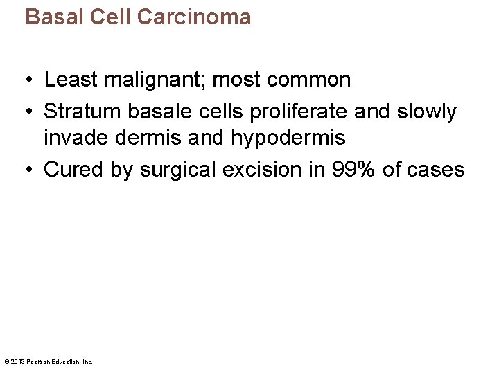 Basal Cell Carcinoma • Least malignant; most common • Stratum basale cells proliferate and