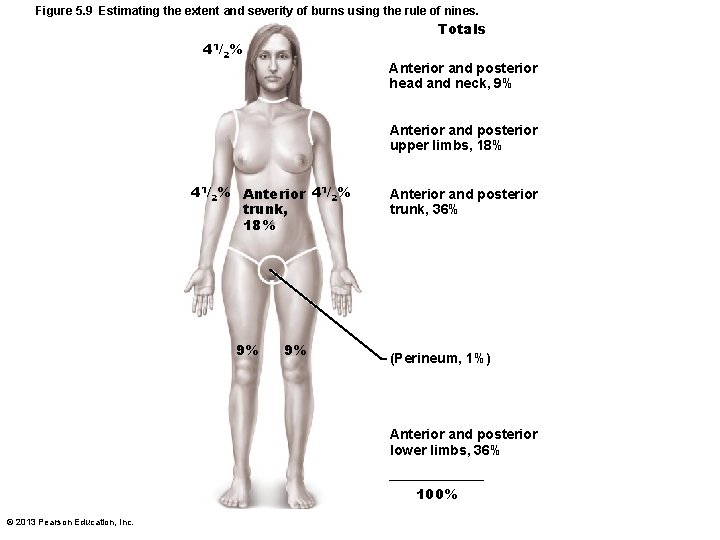 Figure 5. 9 Estimating the extent and severity of burns using the rule of
