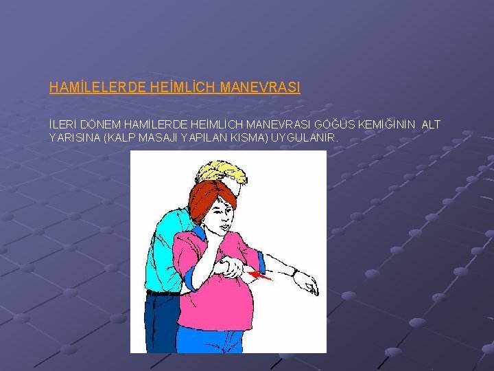 HAMİLELERDE HEİMLİCH MANEVRASI İLERİ DÖNEM HAMİLERDE HEİMLİCH MANEVRASI GÖĞÜS KEMİĞİNİN ALT YARISINA (KALP MASAJI