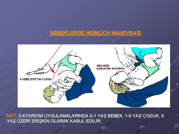 BEBEKLERDE HEİMLİCH MANEVRASI NOT: İLKYARDIM UYGULAMALARINDA 0 -1 YAŞ BEBEK, 1 -8 YAŞ ÇOCUK,