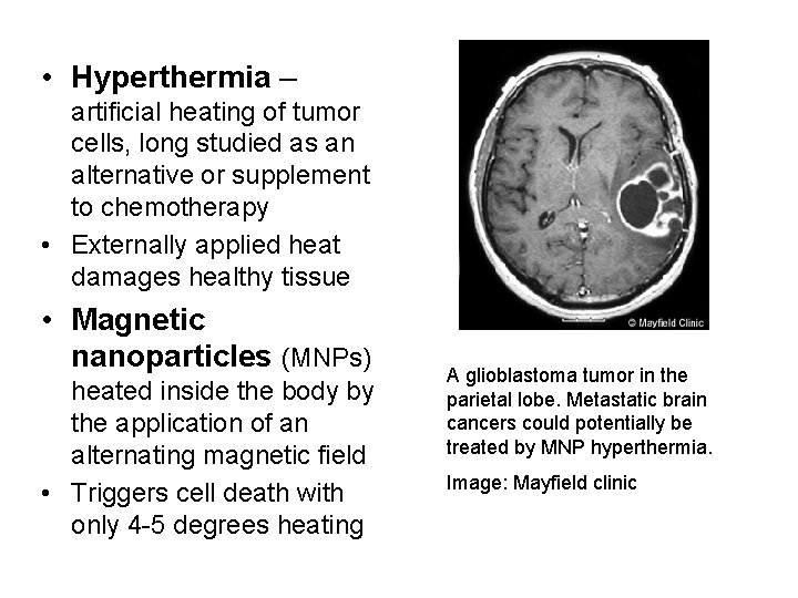  • Hyperthermia – artificial heating of tumor cells, long studied as an alternative