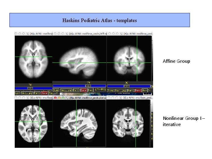 Haskins Pediatric Atlas - templates Affine Group Nonlinear Group I – iterative 