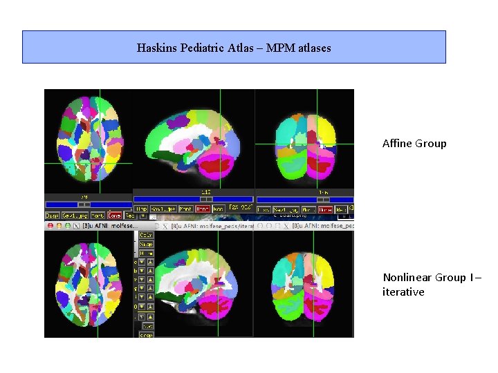 Haskins Pediatric Atlas – MPM atlases Affine Group Nonlinear Group I – iterative 