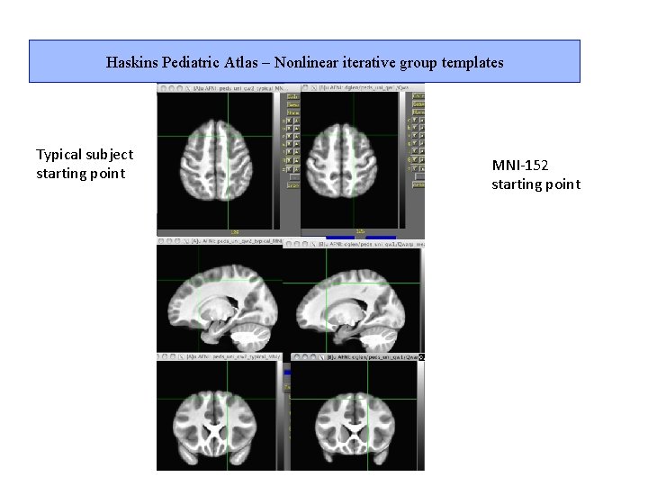 Haskins Pediatric Atlas – Nonlinear iterative group templates Typical subject starting point MNI-152 starting