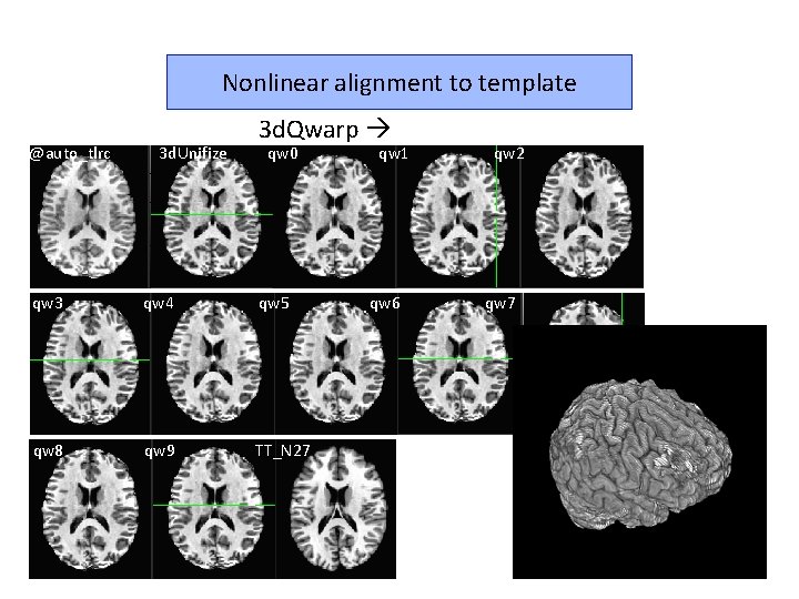 Nonlinear alignment to template @auto_tlrc 3 d. Unifize 3 d. Qwarp qw 0 qw