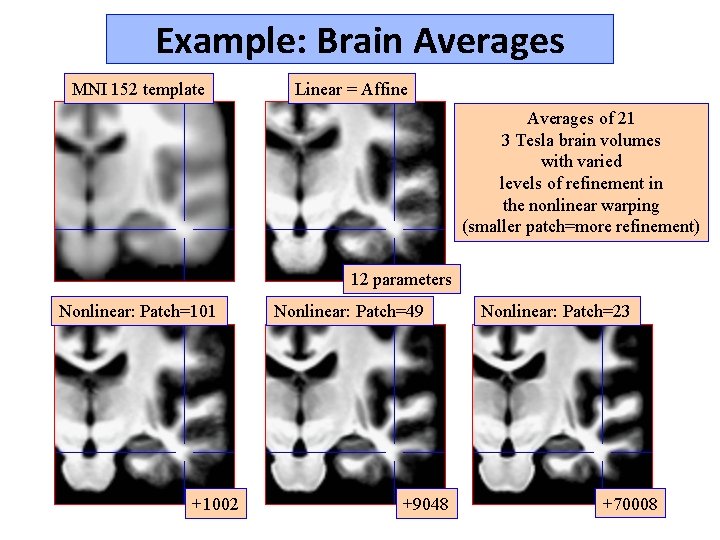 Example: Brain Averages MNI 152 template Linear = Affine Averages of 21 3 Tesla