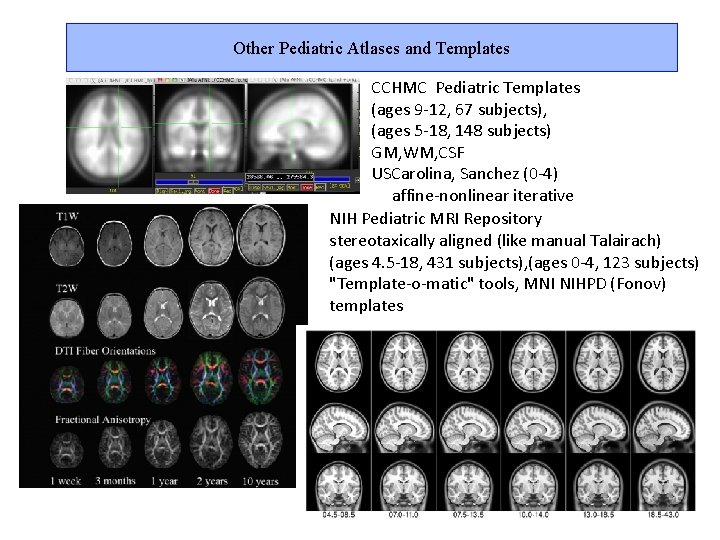 Other Pediatric Atlases and Templates CCHMC Pediatric Templates (ages 9 -12, 67 subjects), (ages