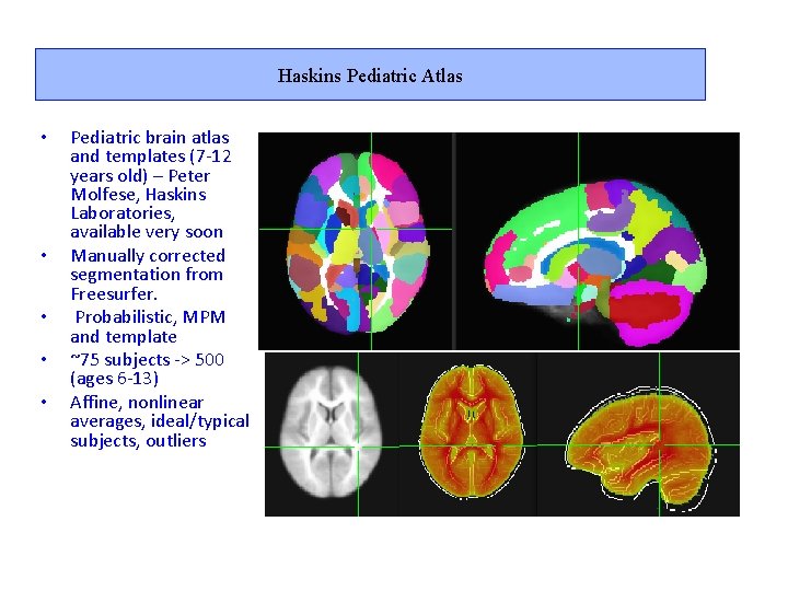 Haskins Pediatric Atlas • • • Pediatric brain atlas and templates (7 -12 years