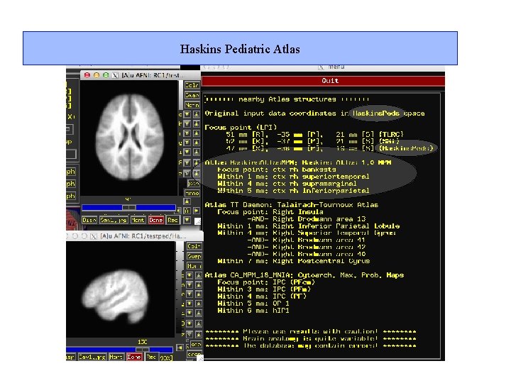 Haskins Pediatric Atlas 