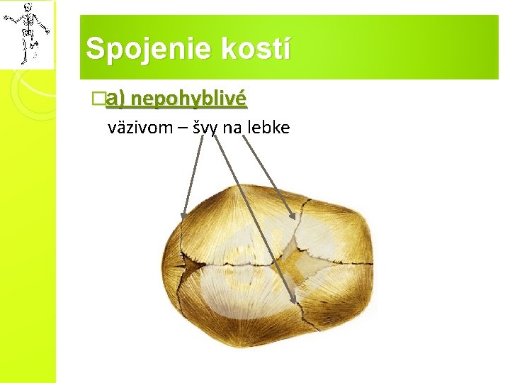 Spojenie kostí �a) nepohyblivé väzivom – švy na lebke 