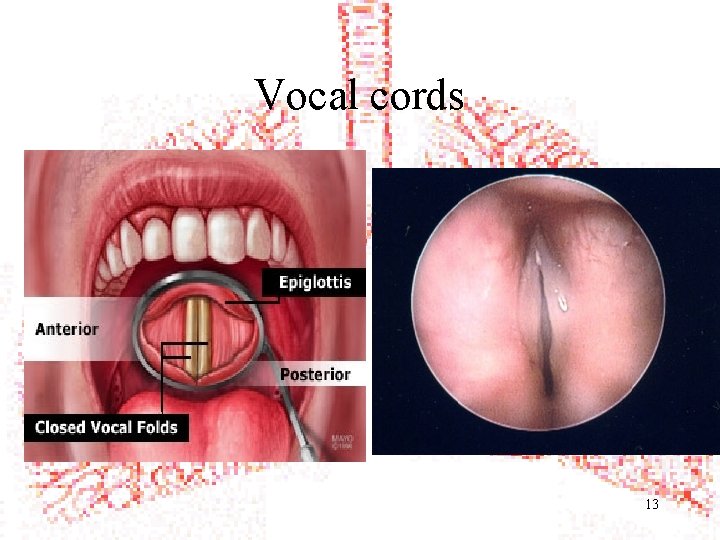 Vocal cords 13 