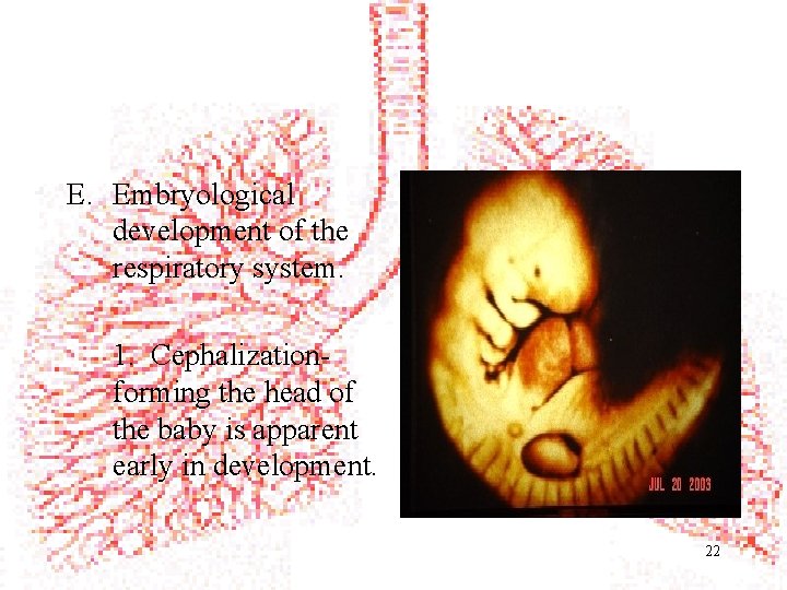 E. Embryological development of the respiratory system. 1. Cephalizationforming the head of the baby