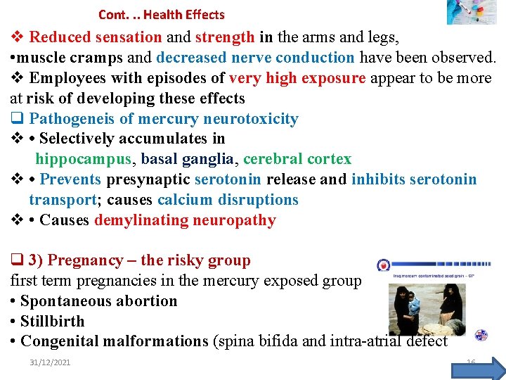 Cont. . . Health Effects v Reduced sensation and strength in the arms and