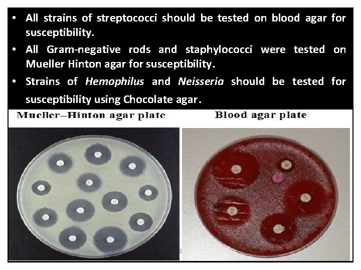  • All strains of streptococci should be tested on blood agar for susceptibility.