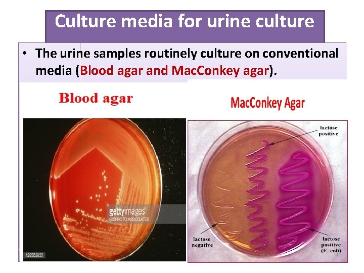 Culture media for urine culture • The urine samples routinely culture on conventional media