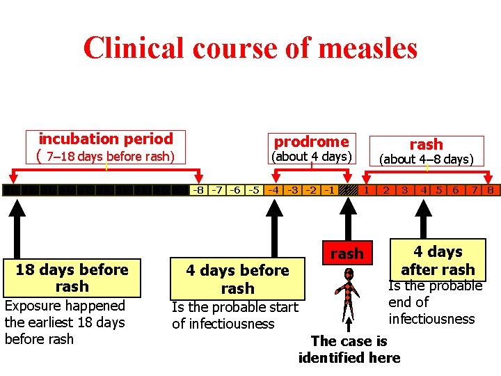 Clinical course of measles incubation period ( 7– 18 days before rash) prodrome (about