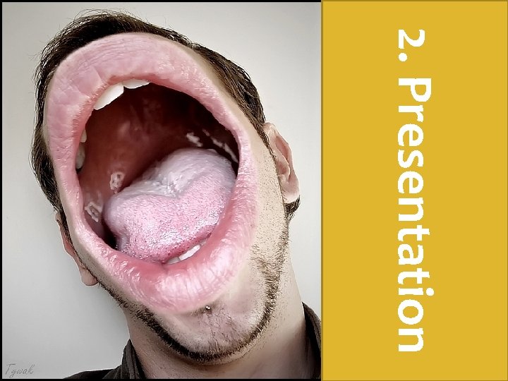 2. Presentation 