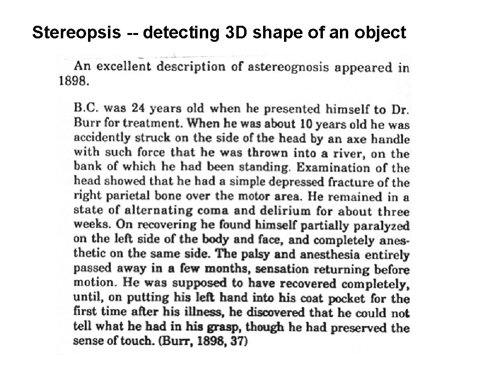 Stereopsis -- detecting 3 D shape of an object Stereopsis -- detecting 3 D shape of an object