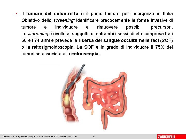  • Il tumore del colon-retto è il primo tumore per insorgenza in Italia.