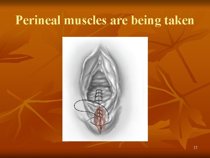 Perineal muscles are being taken 15 