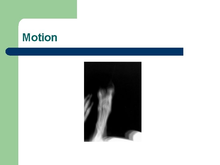 Motion 