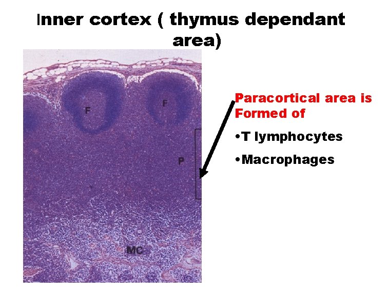 Inner cortex ( thymus dependant area) Paracortical area is Formed of • T lymphocytes
