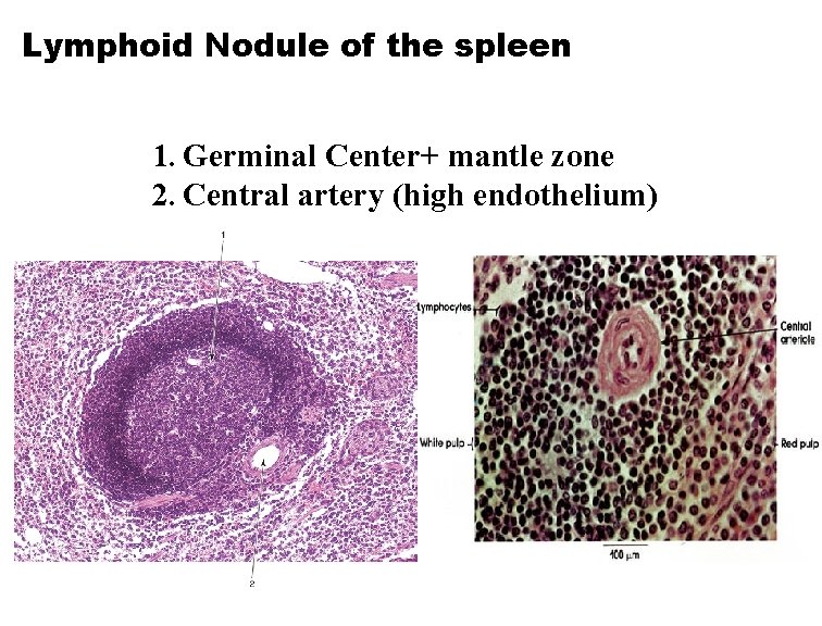 Lymphoid Nodule of the spleen 1. Germinal Center+ mantle zone 2. Central artery (high
