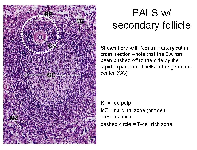 PALS w/ secondary follicle Shown here with “central” artery cut in cross section –note