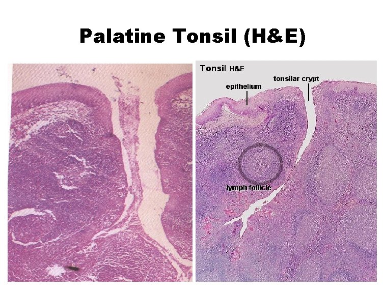 Palatine Tonsil (H&E) 