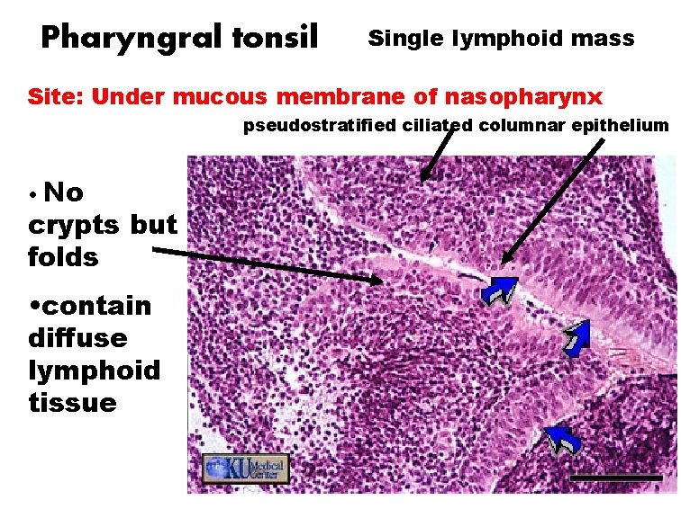 Pharyngral tonsil Single lymphoid mass Site: Under mucous membrane of nasopharynx pseudostratified ciliated columnar