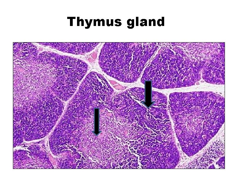 Thymus gland 