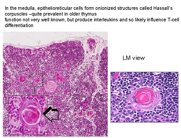 In the medulla, epithelioreticular cells form onionized structures called Hassall’s corpuscles –quite prevalent in