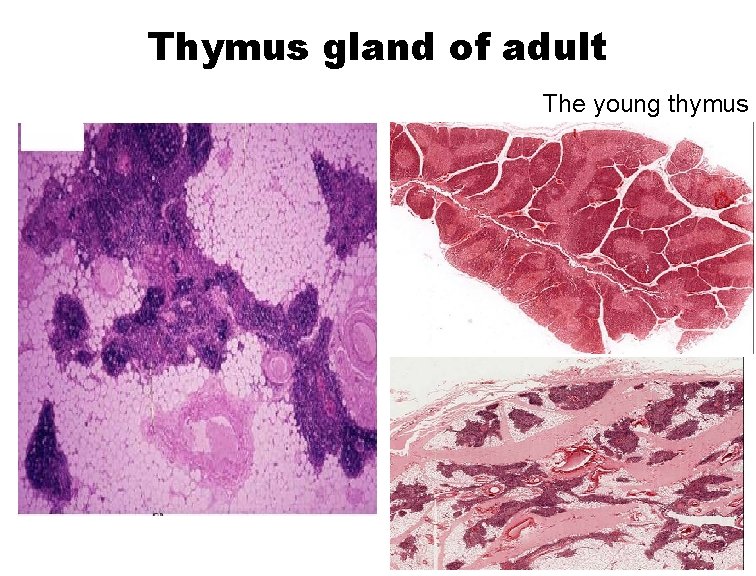 Thymus gland of adult The young thymus 
