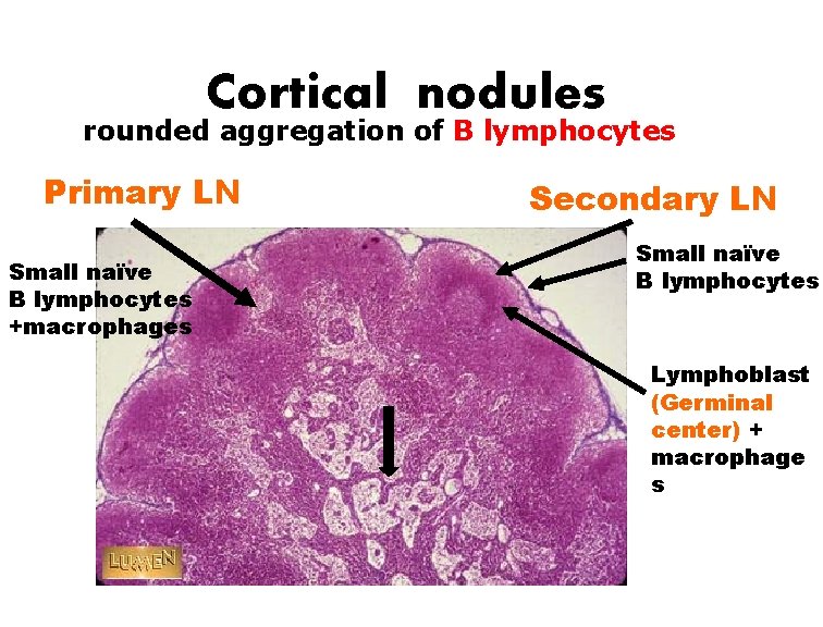 Cortical nodules rounded aggregation of B lymphocytes Primary LN Small naïve B lymphocytes +macrophages