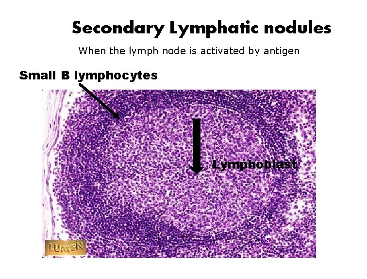 Secondary Lymphatic nodules When the lymph node is activated by antigen Small B lymphocytes