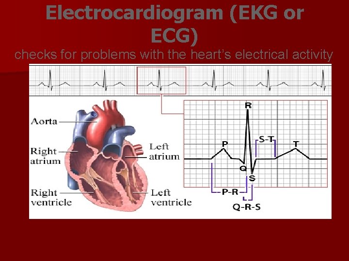 Electrocardiogram (EKG or ECG) checks for problems with the heart’s electrical activity Electrocardiogram (EKG or ECG) checks for problems with the heart’s electrical activity